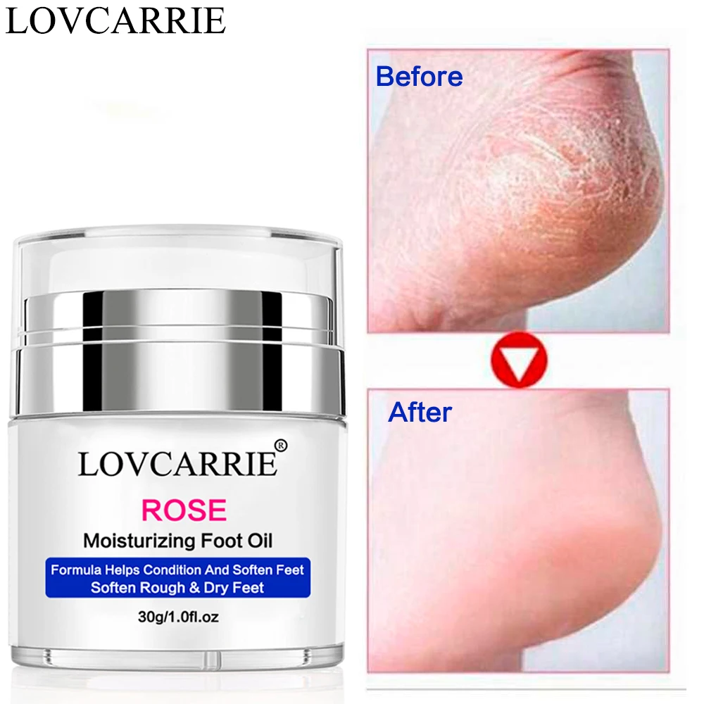 

LOVCARRIE 30g Foot Cream for Dry Cracked Heels New Formula Repair Lotion Nail Strengthener Nourish Cuticle Softener Treatment