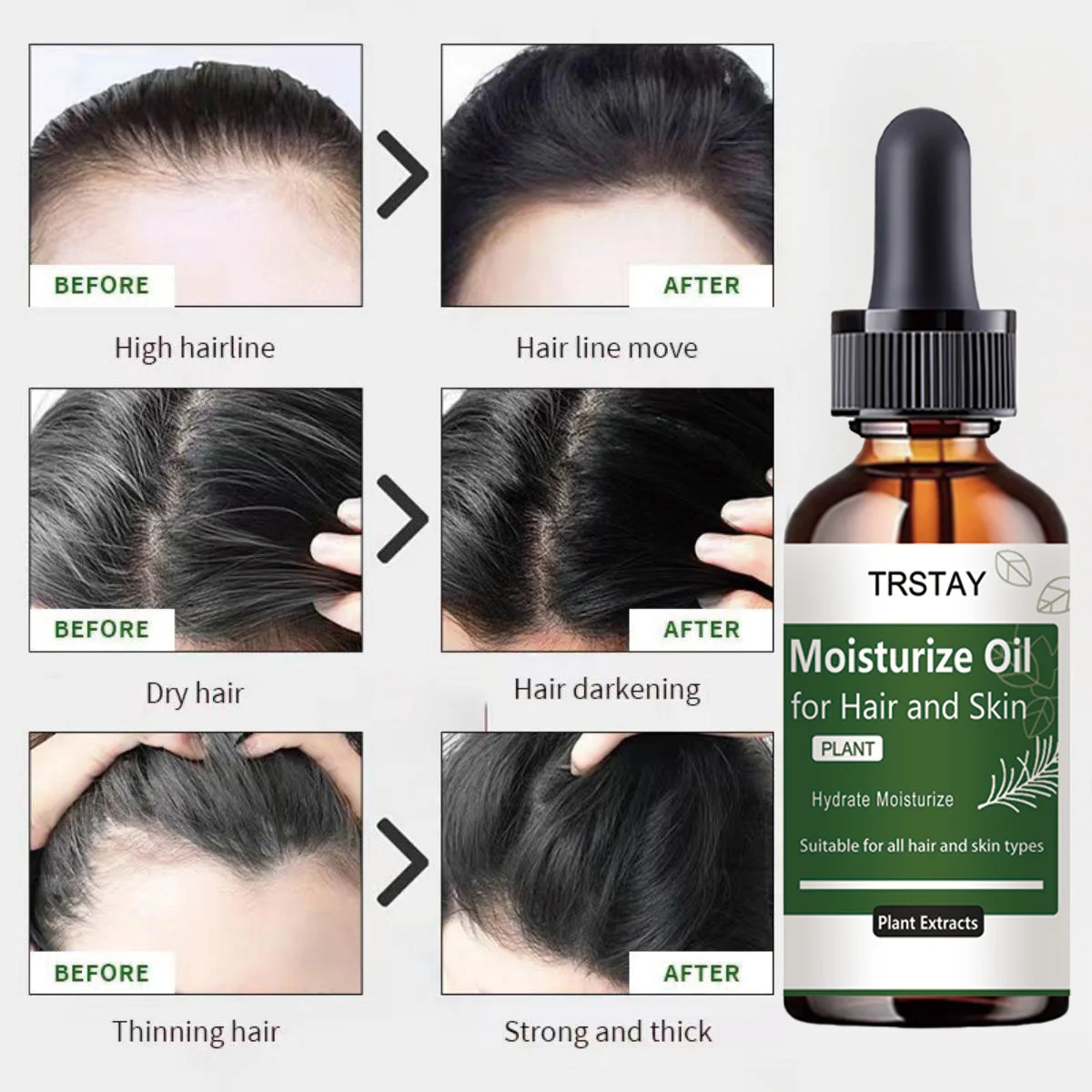 TRSTAY Rosemary Essential Oil Hair & Scalp Strengthening Nourishment Healthy Safe Beauty Hair Activation for Overall Hair Health