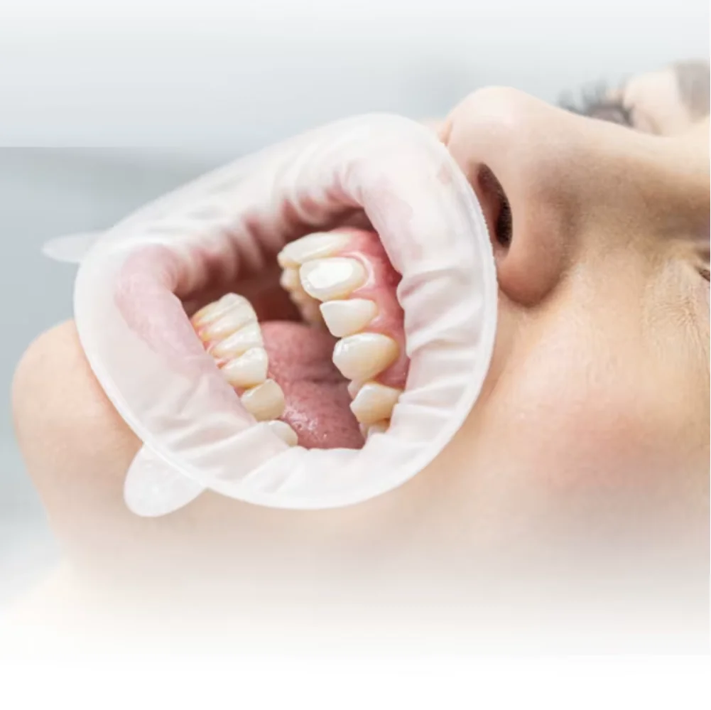 

New Arrival Dentals OptraGate 3D Lip and Cheek Retractor 40pcs/box Refill Packing Regular Small Junior