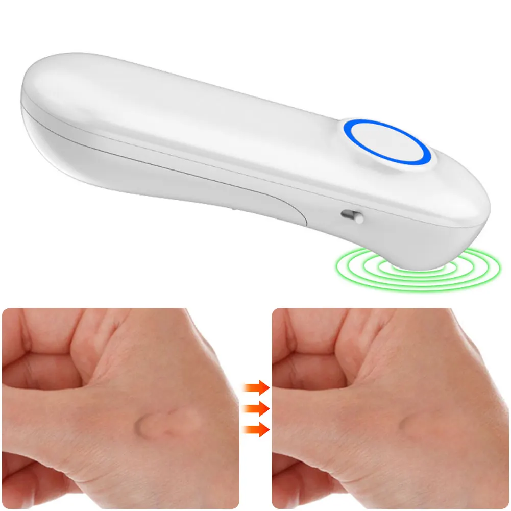 Portable Physical Itching Relief Pen Electric Anti-itch Device Relieve Mosquito Bites Stick for Adventure Outdoor Sports Camping