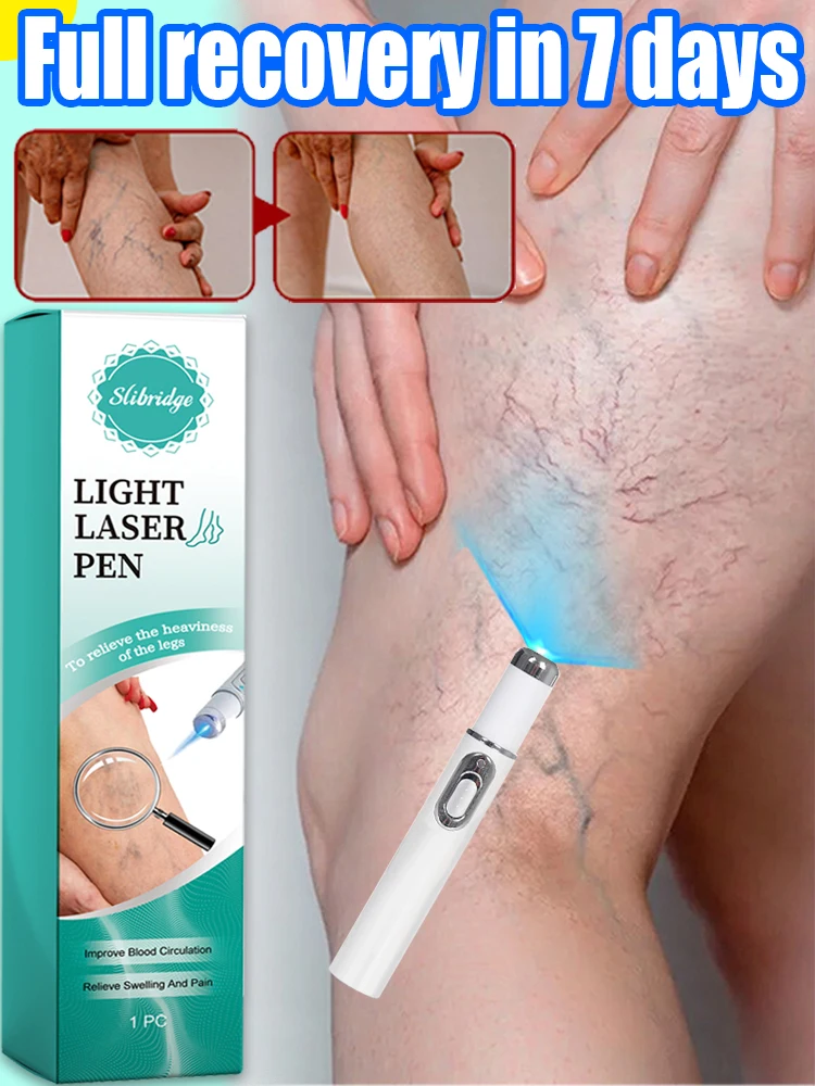 Il Laser risolve vari problemi alle gambe