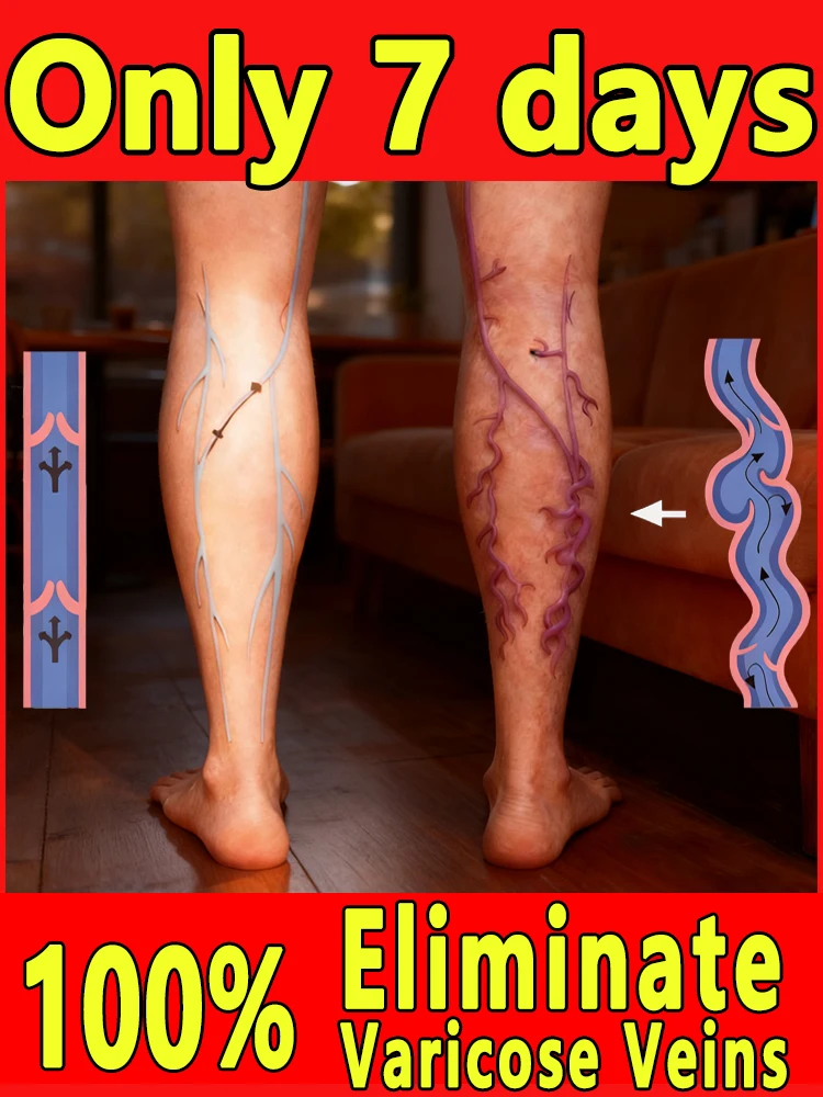 Lᴇɢ Cᴏᴍғᴏʀᴛ Dᴇᴠɪᴄᴇ - Pᴏʀᴛᴀʙʟᴇ Lᴀsᴇʀ Tʜᴇʀᴀᴘʏ ғᴏʀ Aᴄʜɪɴɢ Lᴇɢs, Hᴏᴍᴇ & Tʀᴀᴠᴇʟ Usᴇ