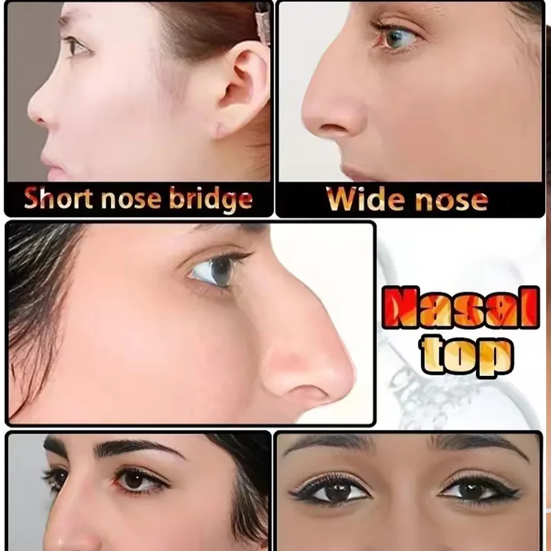 ยกสะโพกจมูกให้สูงขึ้นและลดขนาดของจมูก จมูกมันและบาง การแก้ไขรูปทรงจมูกด้วยการผ่าตัดเสริมจมูก