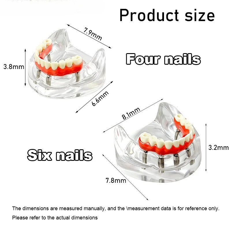 1Pcs Dental 4/6 Implant Models Denture Restoration Implant Teeth Removable Oral Education Patient-Doctor Communication Materials