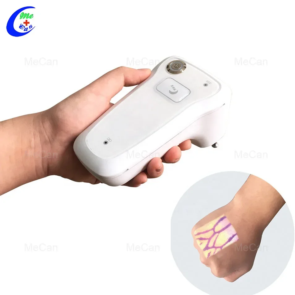 

Handheld Vessel V5 Medical Infrared Vein Viewer ,Vein Scanner, Portable Infrared Vein Finder