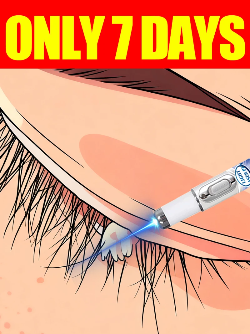 

Wart blue light tool, more discounts on sets