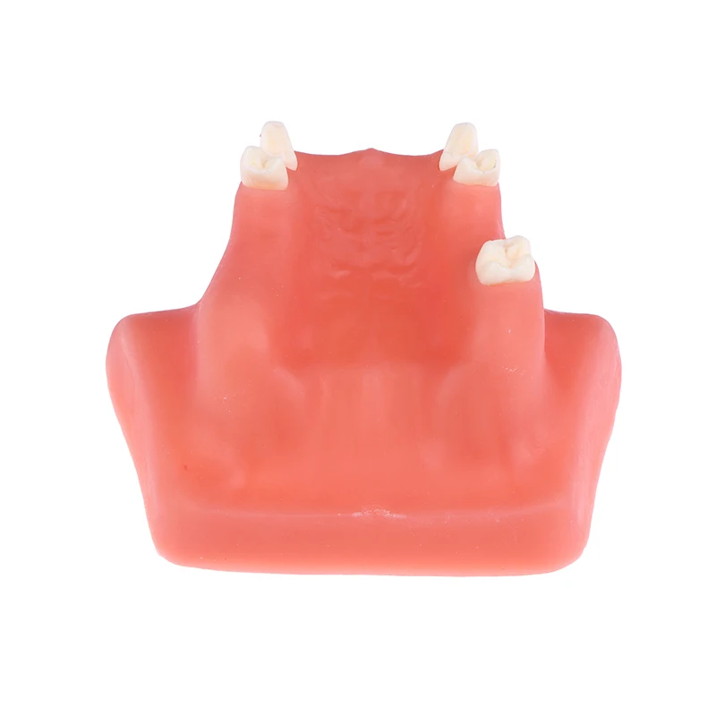 

Модель зубов верхнещелепной пазухи, обучающая модель зубного имплантата для стоматолога, практика студента, изучение, оральная медицинская модель