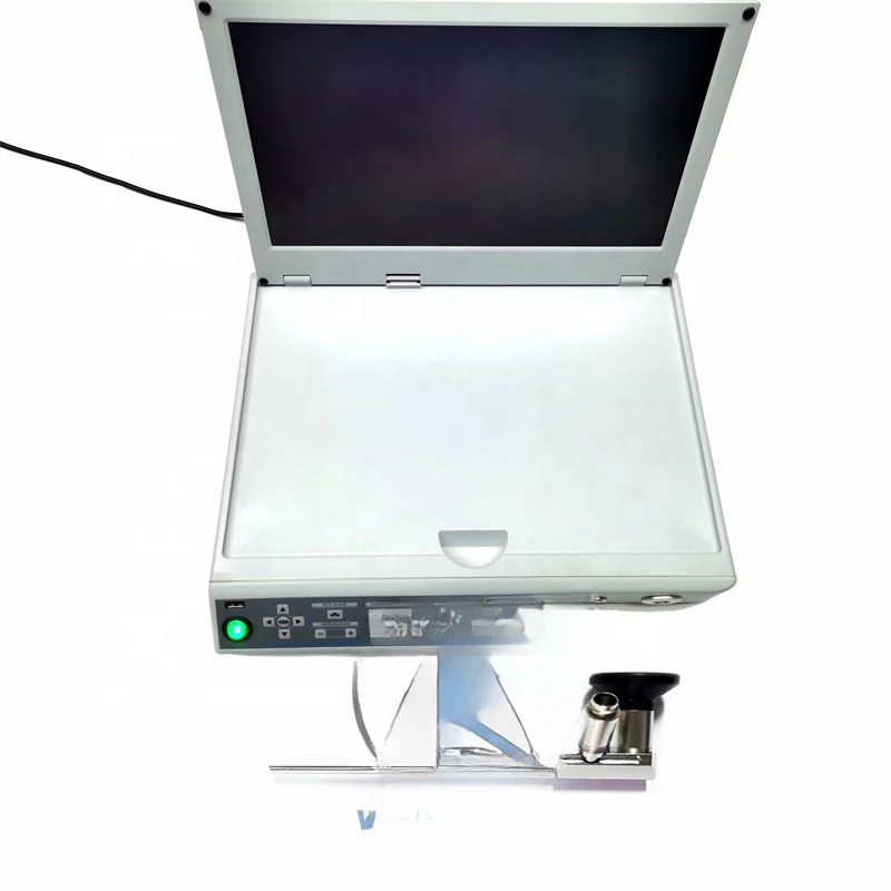 HD Video portable endoscopy  with all kinds of rigid endoscope endoscopy ureteroscope