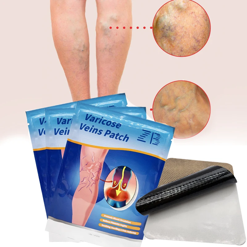 Traditional Chinese Medicine Varicose Veins Patches Relieve Numbness Swollen Pain Dressing Promoting blood Circulation Patches