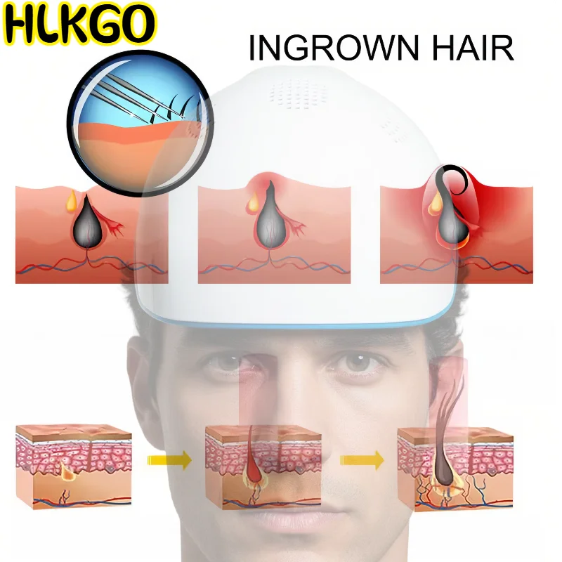 

Laser Therapy Hair Growth Cap 80 LEDs 650nm Red Light for Scalp Health Hair Density and Relaxation Care