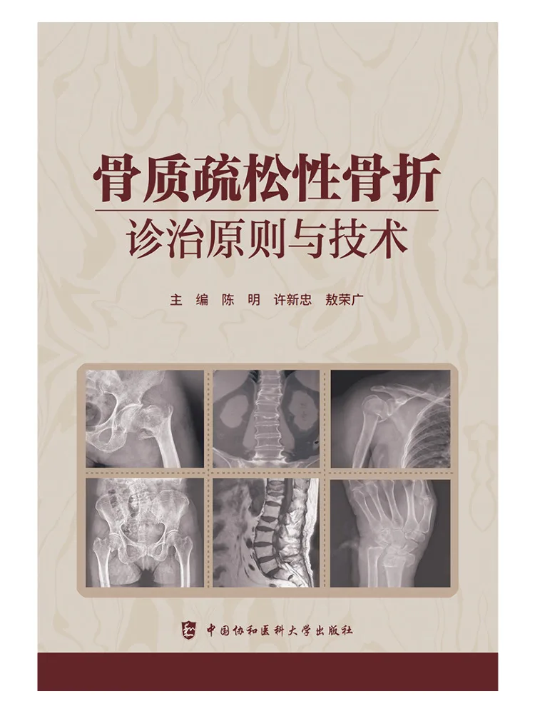 Book-Winshare Osteoporotic Fractures Diagnosis Treatment Principles and Techniques