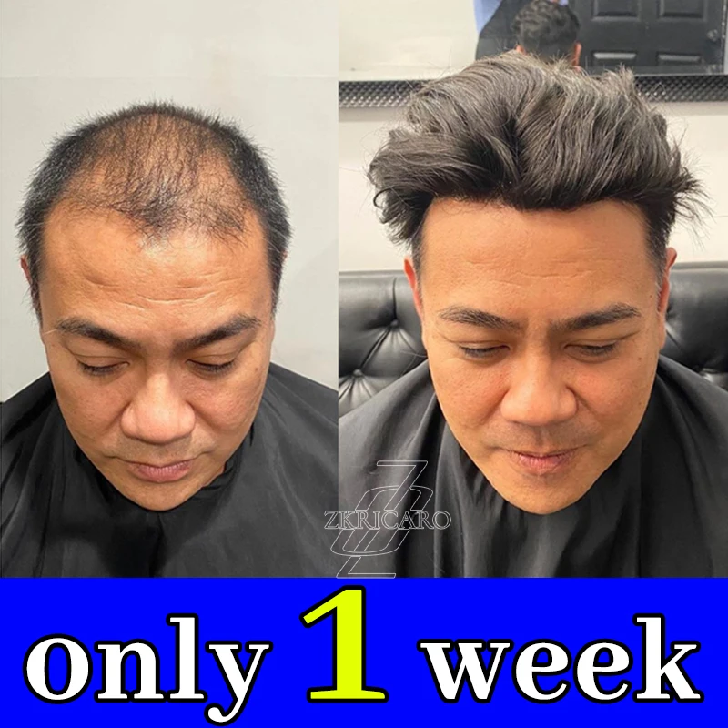 

vitamin C penetration,Hair "Up" Say goodbye to the awkwardness of flat hair.