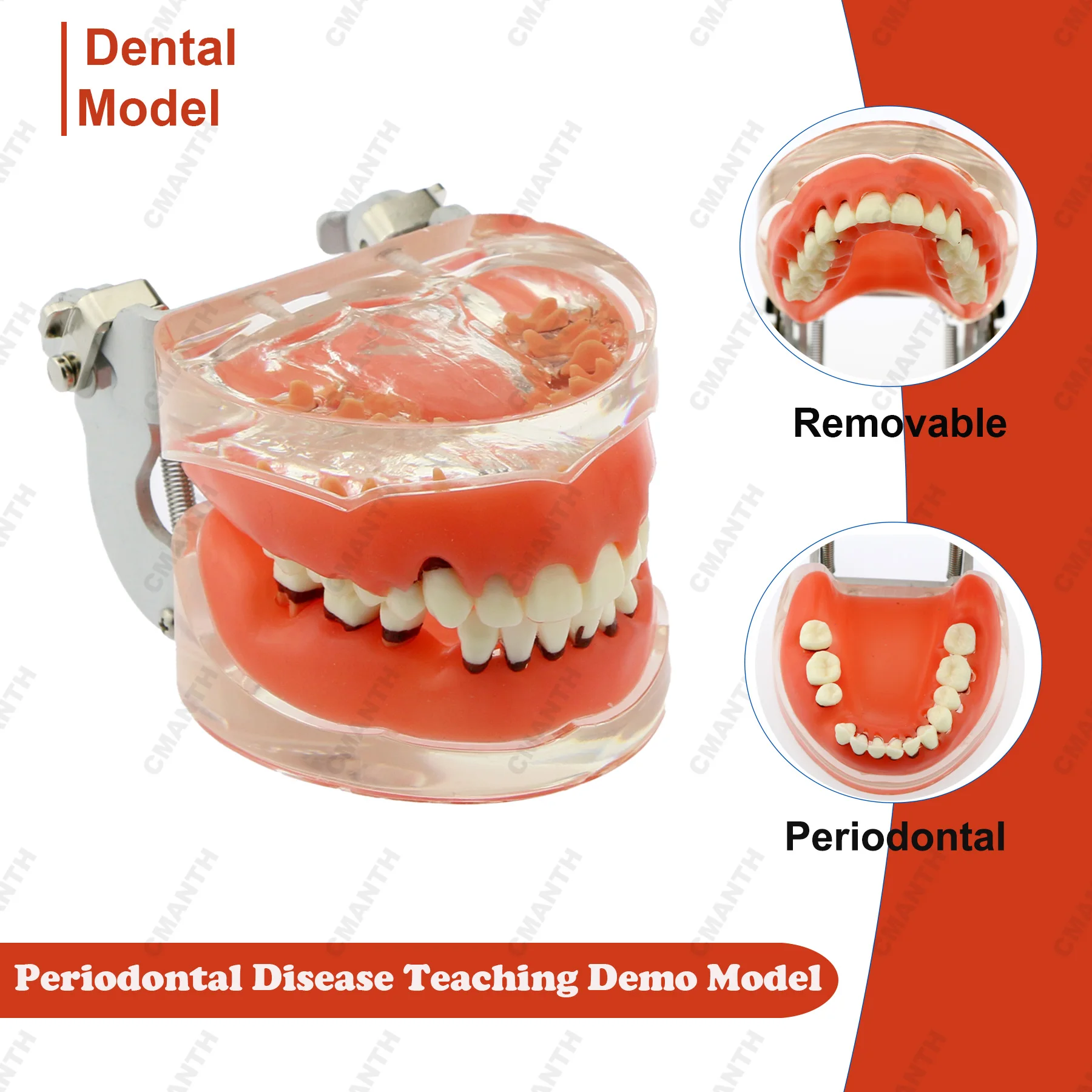 

Модель стоматологической смолы, заболевания пародонта, патологическая обучающая модель для стоматолога, изучения пациента, образования, демонстрационные аксессуары M4017