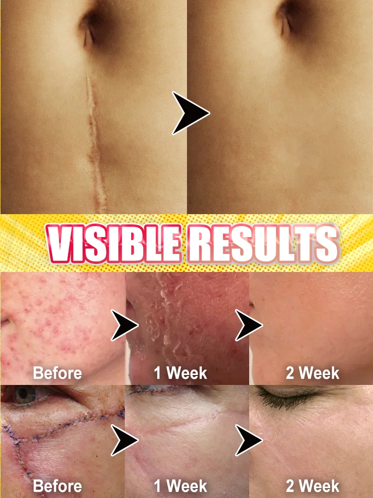 2025年最新レーザー療法による様々な外科的治療と臥床期の治療