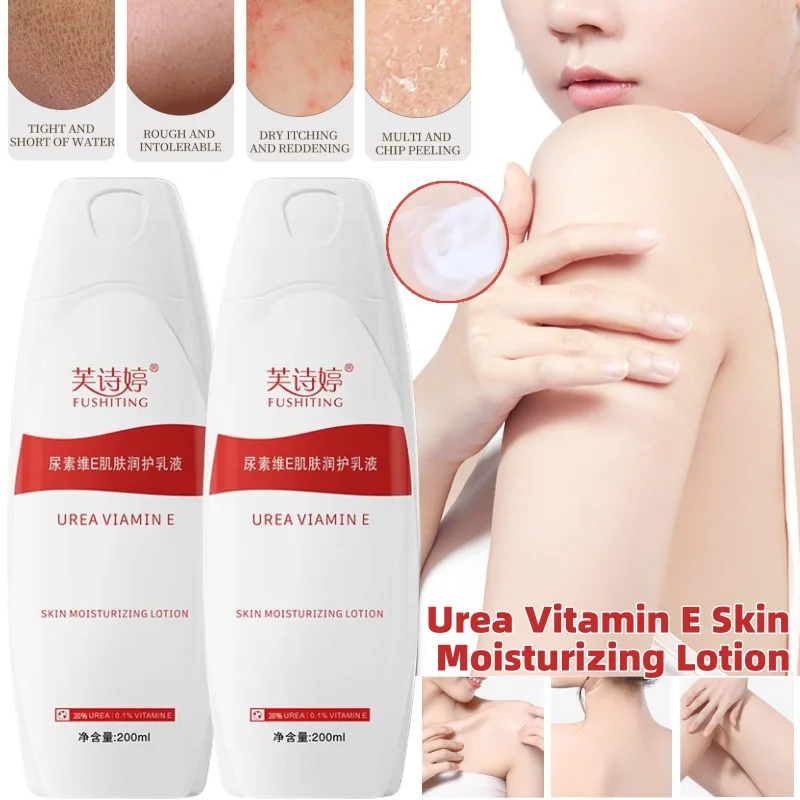 

20% Urea Vitamin E Lotion Brightens Skin Exfoliates Improves Dry and Peeling Skin Urea Cream Moisturizing Body Lotion 200ml