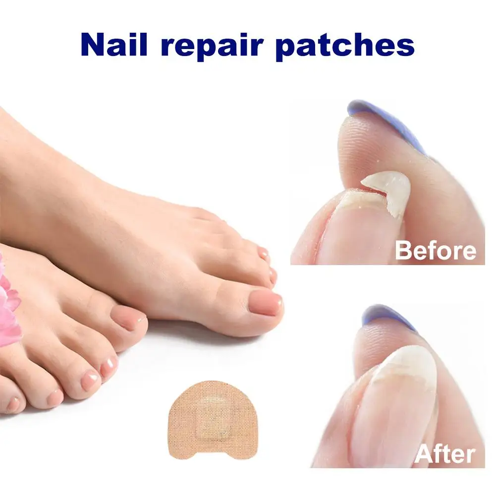 Nail Repair Patches Toenail Renewal Correction Sticker Paronychia Recovery Pedicure Tools Split Nails Protection Tape