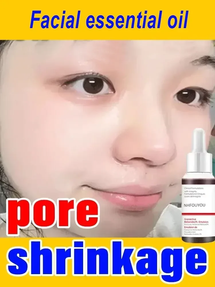 Essência de cuidados com a pele Minimizando os poros faciais Reparando o soro de beleza para suavizar e apertar o rosto; Minimizar os poros