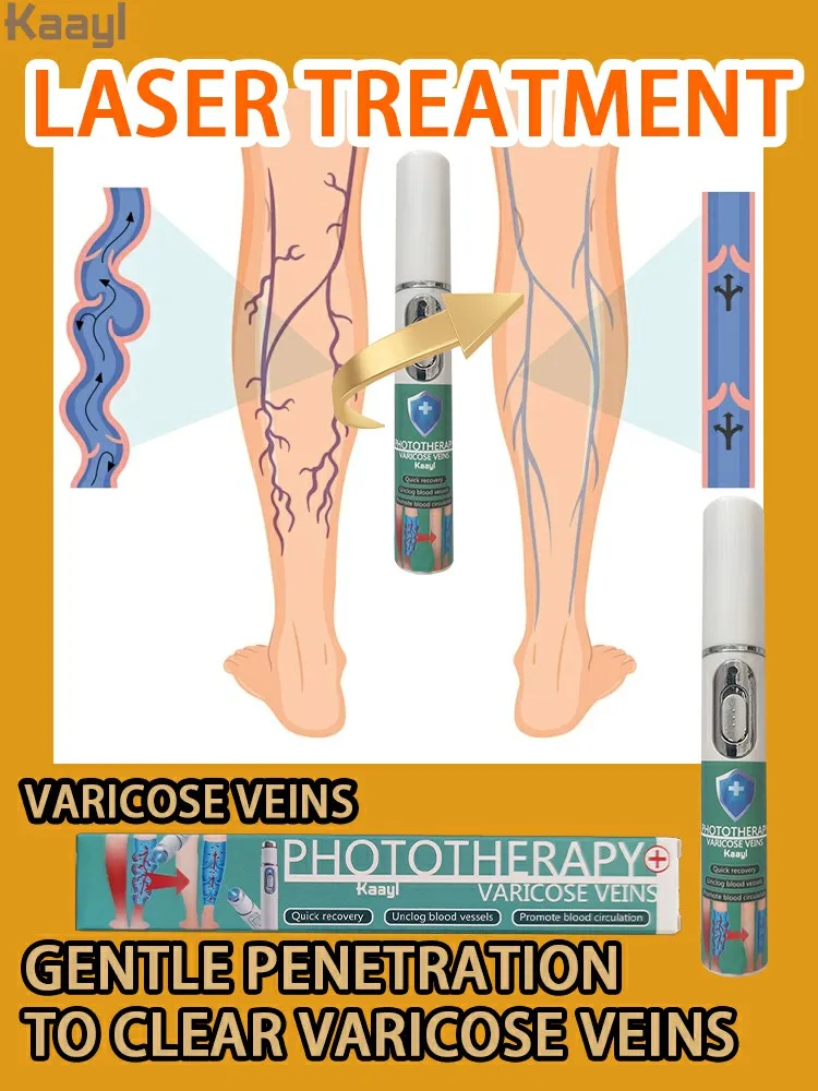 

Laser vein | Improves Blood Circulation | Reduces Spider Veins and Heaviness