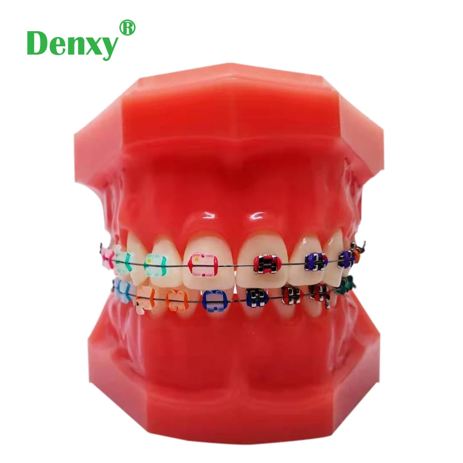 Dental Teaching Model Typodont With  Orthodontic  Metal Ceramic Bracket Arch Wire Buccal Tube Ligature Tie Medical Education