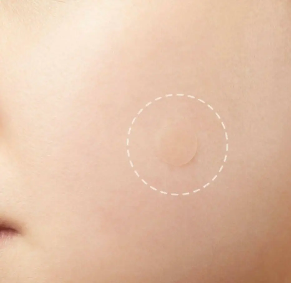 24/36 個のスキンタグニキビパッチドットハイドロコロイドニキビニキビ除去パッチ