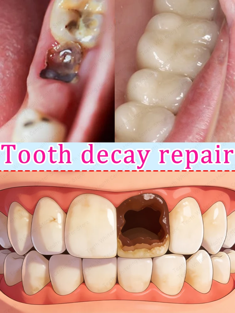A toothpaste that improves oral healthᴀɴᴅ ʀᴇᴘᴀɪʀs ᴄᴀᴠɪᴛɪᴇs ɪɴ 3 ᴅᴀʏs.