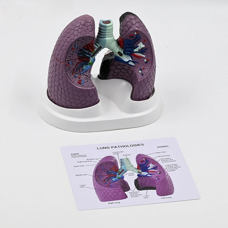 

Модель легких человека. Хвороба курения. Респираторный образец. Здоровая толстая хирургия легких. Анатомическая модель легких.