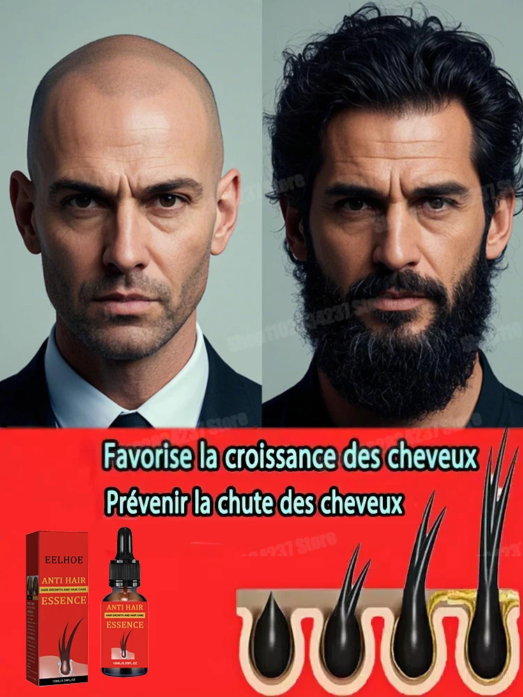 

Hair Loss Prevention Essence for Hair Growth, Hair Care Oil for Men and Women