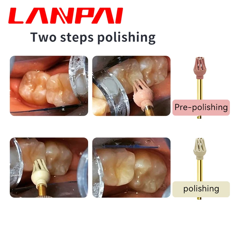 Lanpai Dental Rubber Diamond  Composite Resin Polishing RA Dentist Tools Dentistry Materails polish in polish