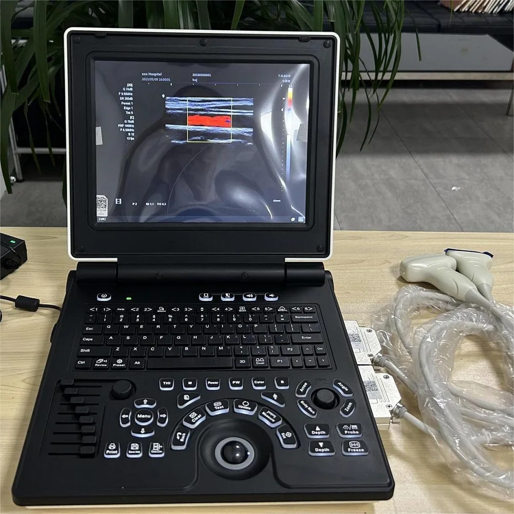 Portable Veterinary Color Doppler Ultrasound Machine, 12 Inch Display, Pasture Animal Diagnostic Ultrasound Equipment