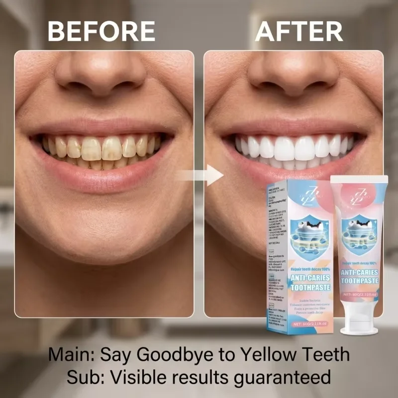 1 PC Anti Decay Toothpaste, Deeply Disintegrates Stubborn Smoke and Tea Stains, Black and Yellow Tartar for 10 Years, Whitens and Brightens Teeth Without Damaging Enamel, Removes Bad Breath and Leaves a Mint Fragrance. Brush It in the Morning and Evening