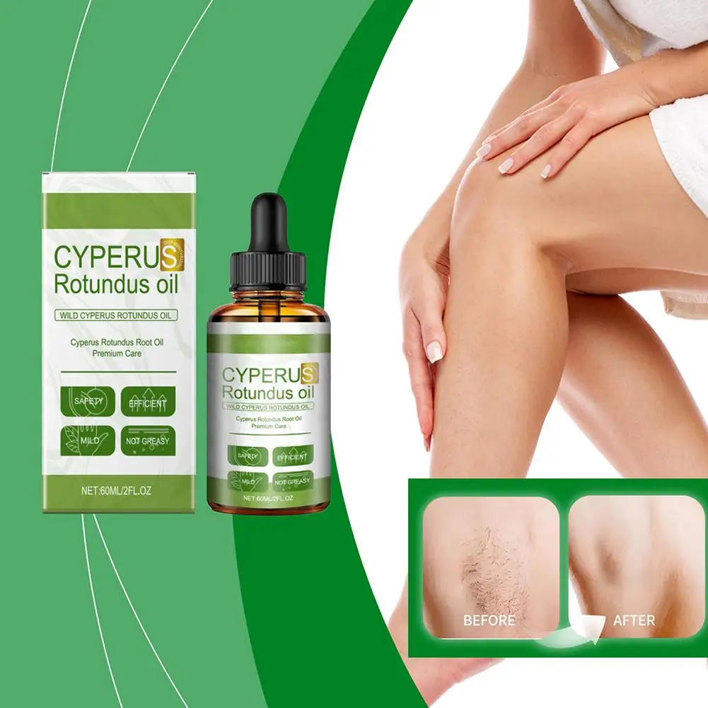 Масло Cyperus, увлажняющее, питательное, для удаления волос на теле, уход за разглаживающим маслом, средство Rotundus, уменьшение ципера, покраснение тела P6u7