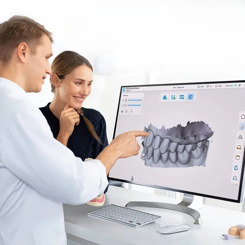 Fast Scanning 3D Intraoral Scanner High Accuracy 10μm Full Arch Portable Digital Scanner for Prosthesis and