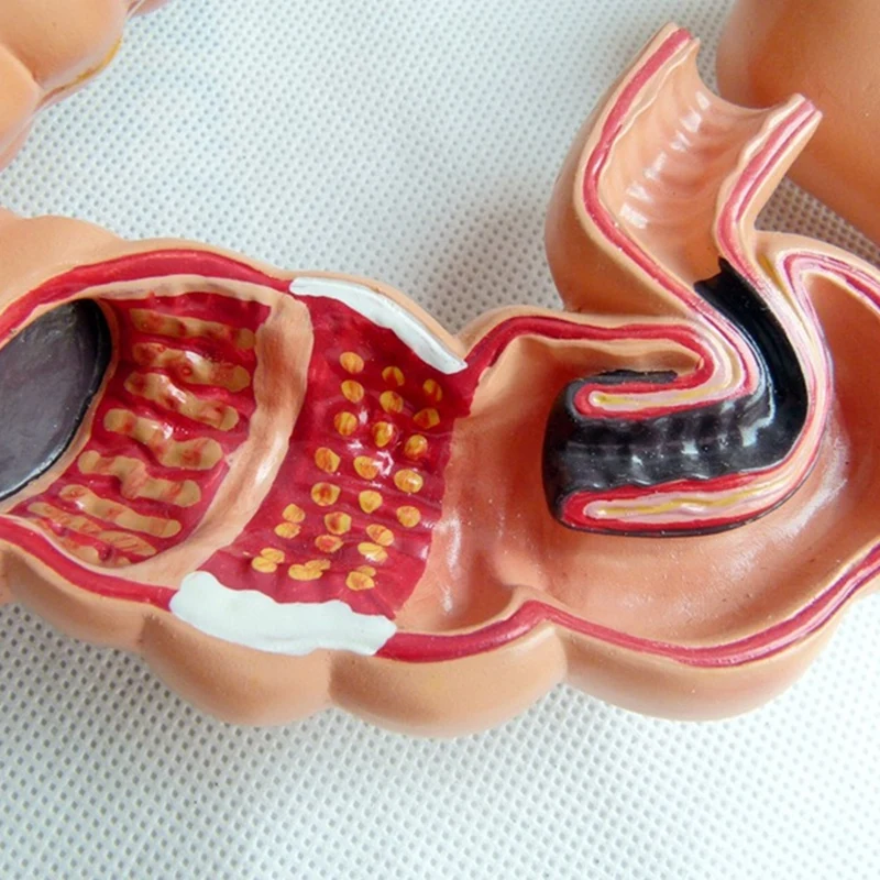 Model dydaktyczny, model anatomii jelit grubych ludzi Model uszkodzenia wizjerów System trawienia człowieka Model edukacyjny łatwy w użyciu