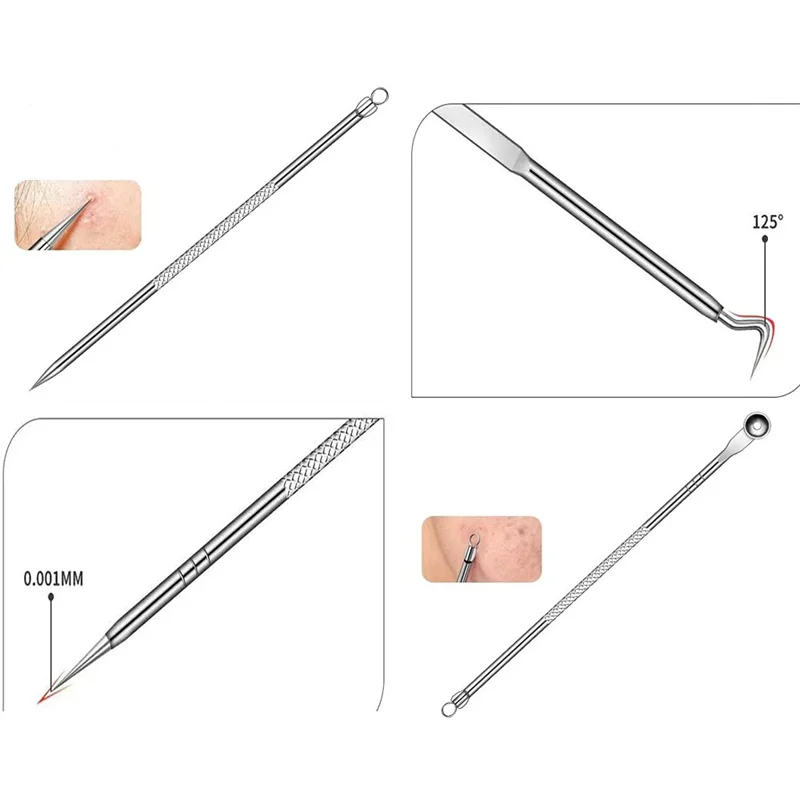 Mitesser-Entferner-Werkzeug, Komedonen-Extraktor, Akne-Entfernungsset für Makel, Whitehead Popping für Gesichts-Nase, Pickel-Popper-Werkzeug-Set