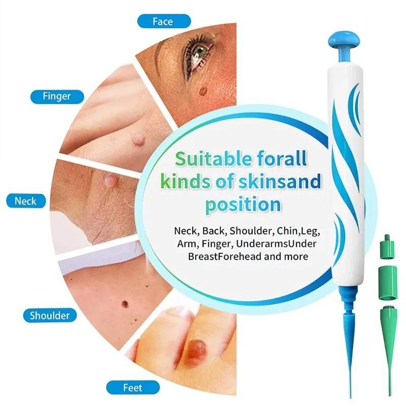 Juego de bolígrafo 2 en 1 para eliminar verrugas, eliminador automático de verrugas y lunares, cuidado facial para adultos