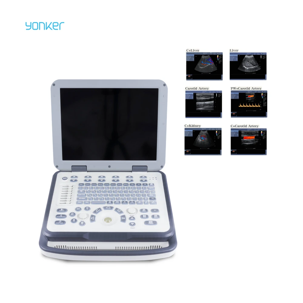 Yonker Ul8 Portable Doppler Ultrasound Machine 15 Inch Medical Double Probe Multi Language Ultrasound Machine