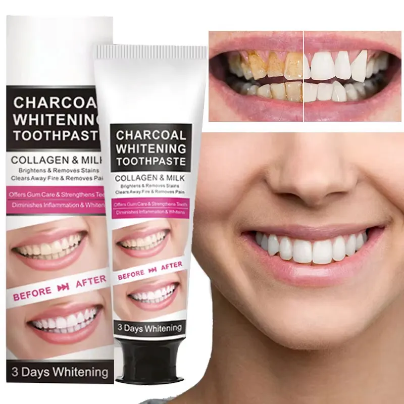 

Зубная паста для глубокой очистки зубов — удаляет неприятный запах изо рта, нежный уход за полостью рта, освежает дыхание, не раздражает уход за полостью рта