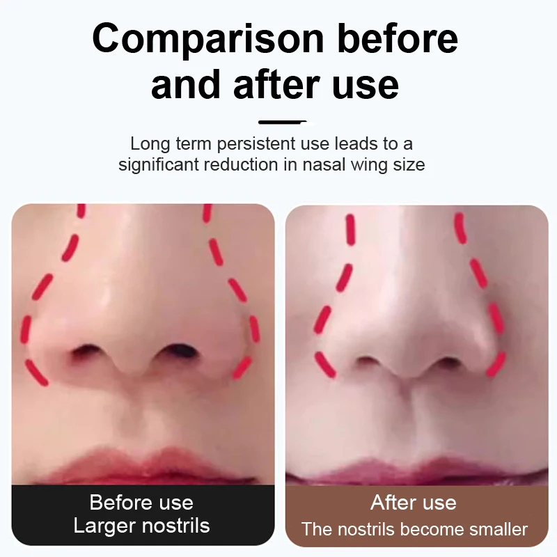 2Rolls/box Beauty Nose Up Lifting Bridge Shaper Massage Tool No Pain Nose Shaping Clip Clipper Women Girl Massager