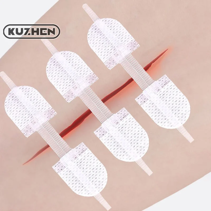 Strap Zipper Wound Closure Patches Breathable Seamless Elastic Zip Sutures Bandages For Wound Care Braces Supports