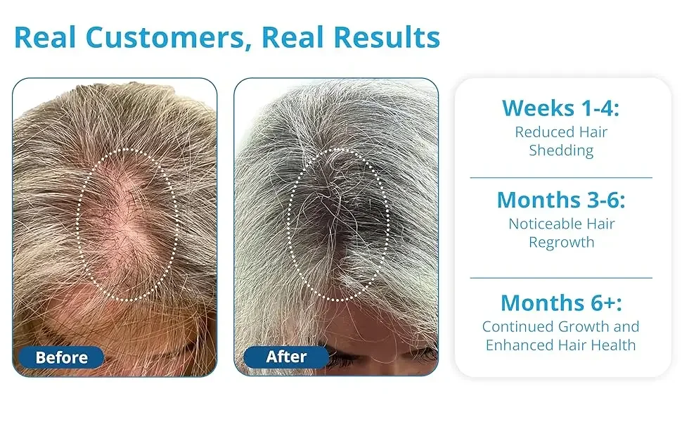 real customer hair loss