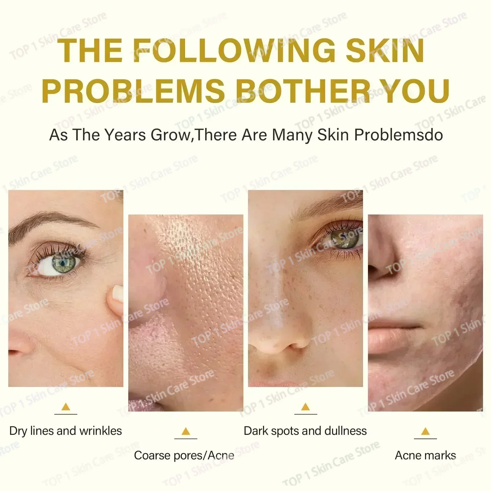 Peeling Serum Bleken Donkere Huidvlekken Verwijderen Dode Huid Melanine Scrub Exfoliërende Witten Hydrateren Huid Verjongende Essentie