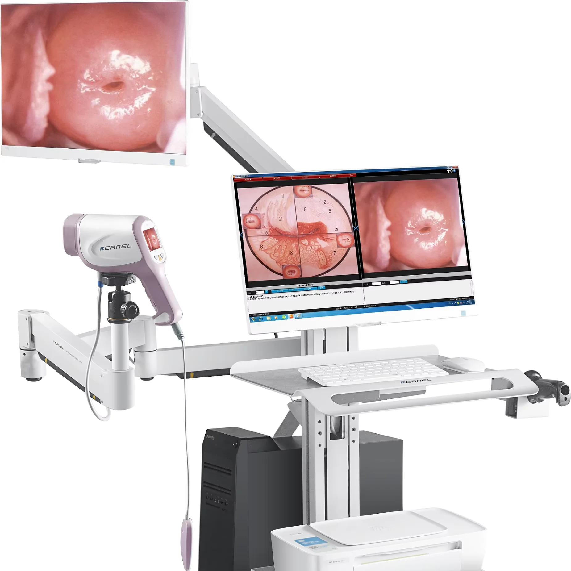 2026 Hot Newest Kernel KN-2200IH Portable Electronic Video Colposcop Digital Video Vagina for Gynecology