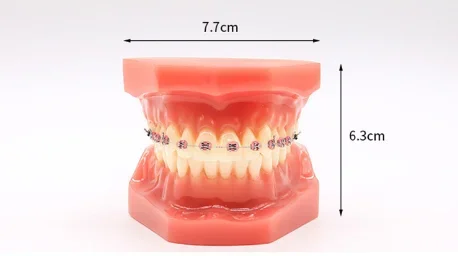 32 Tooth Full Mouth Transparents Impants Diseases Teeth Models Dentists Standards Pathologics