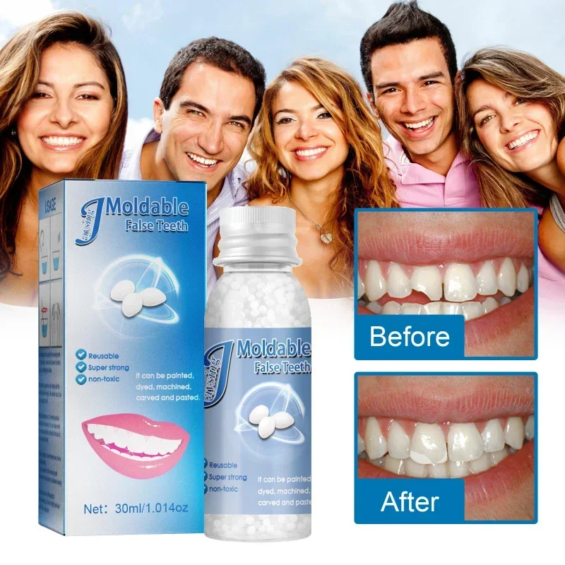 Resin Tooth Repair Glue Shapeable Teeth Gaps Filling Solid Glue Temporary Teeth Repair Falseteeth Glue Safety Dental Supplies