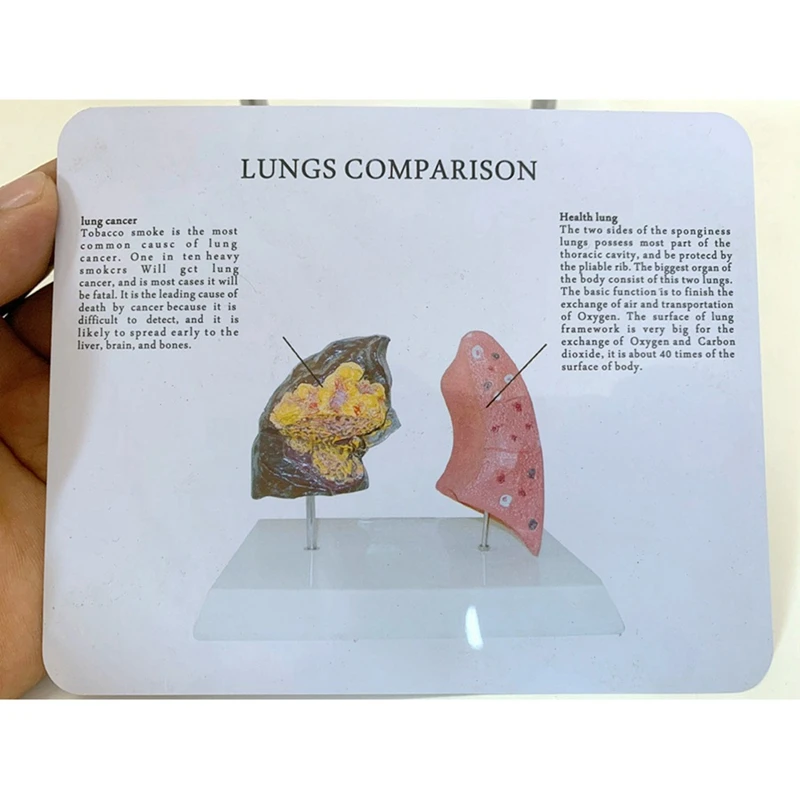 Smoker's Lung Model Healthy Lung Model Lung Anatomy Model With Pathological Respiratory System Disease Lungs