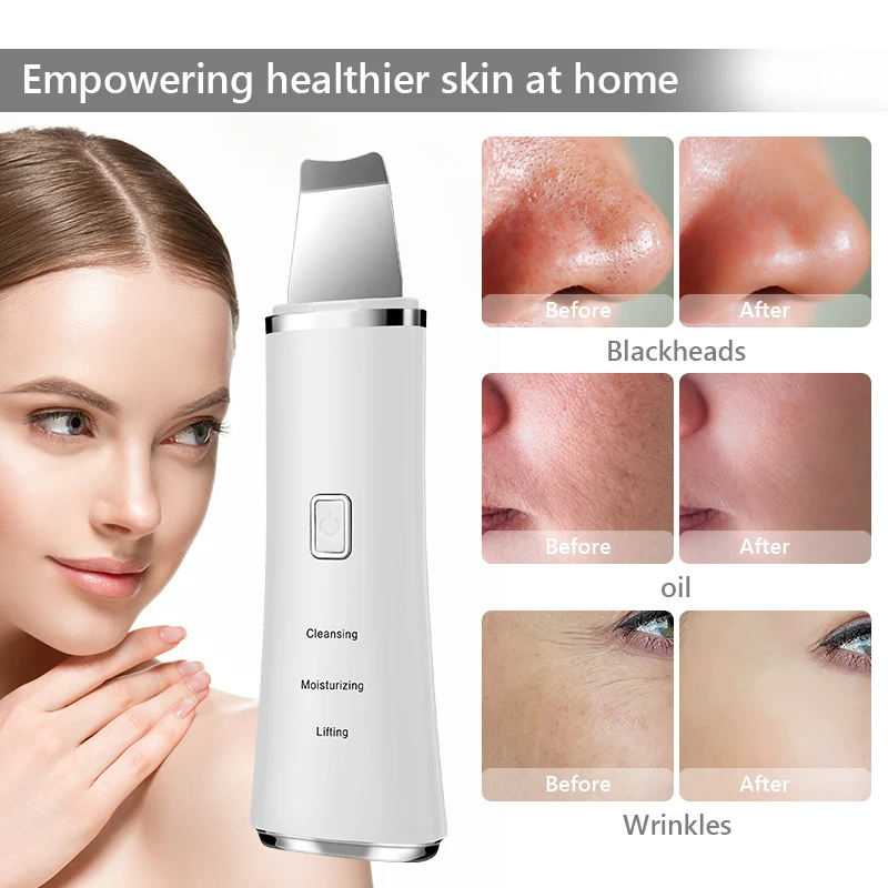 スキンクレンザー,ディープフェイシャルクレンジング,ピーリング,フェイシャル,ポアクリーナー,ラバーリフト