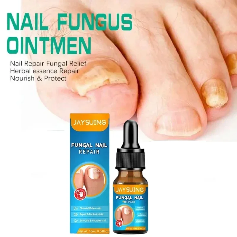 

Extra Strong Nail Fungus Treatment Serum Essence oil Feet Nails Repair Care Essence Cream Anti Infection Toe Fungal Removal 4185