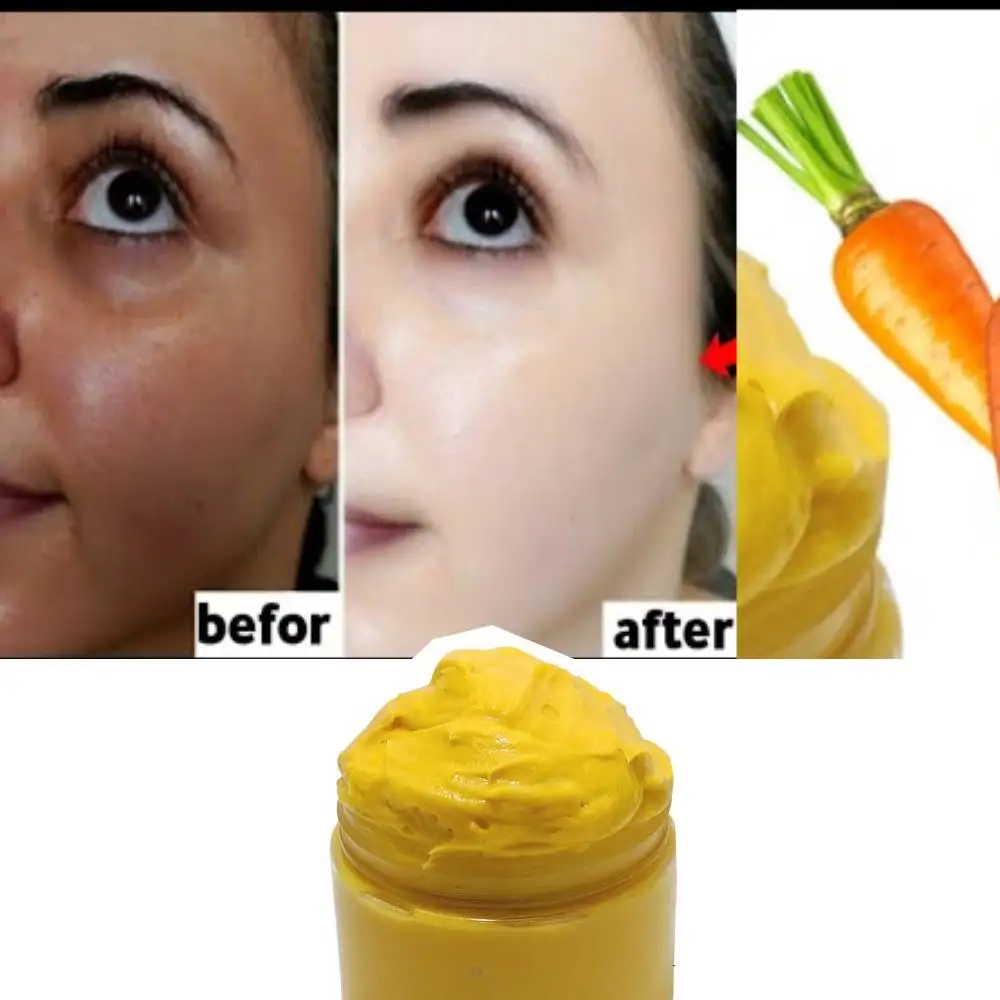 Carrot Cream Kojic Whitening and Brightening Inhibiting Melanin Anti-aging Acne-removing Facial Skin Care Products