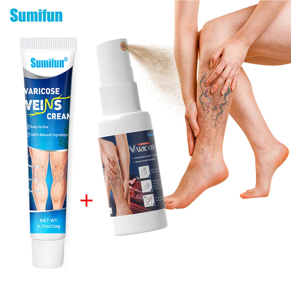 

2Types Sumifun Varicose Veins Spray Vasculitis Phlebitis Legs Spider Treatment Cream Varicosity Angiitis Herbal Medical Ointment