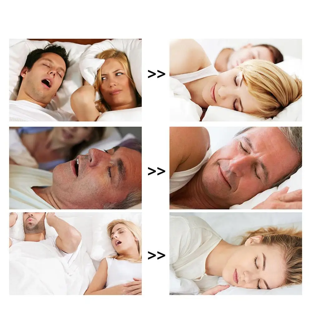 Stop snoring Nasal Strips Works Instantly Improve Sleep Reduce Snoring Relieve Nasal Congestion Due To Colds & Allergies